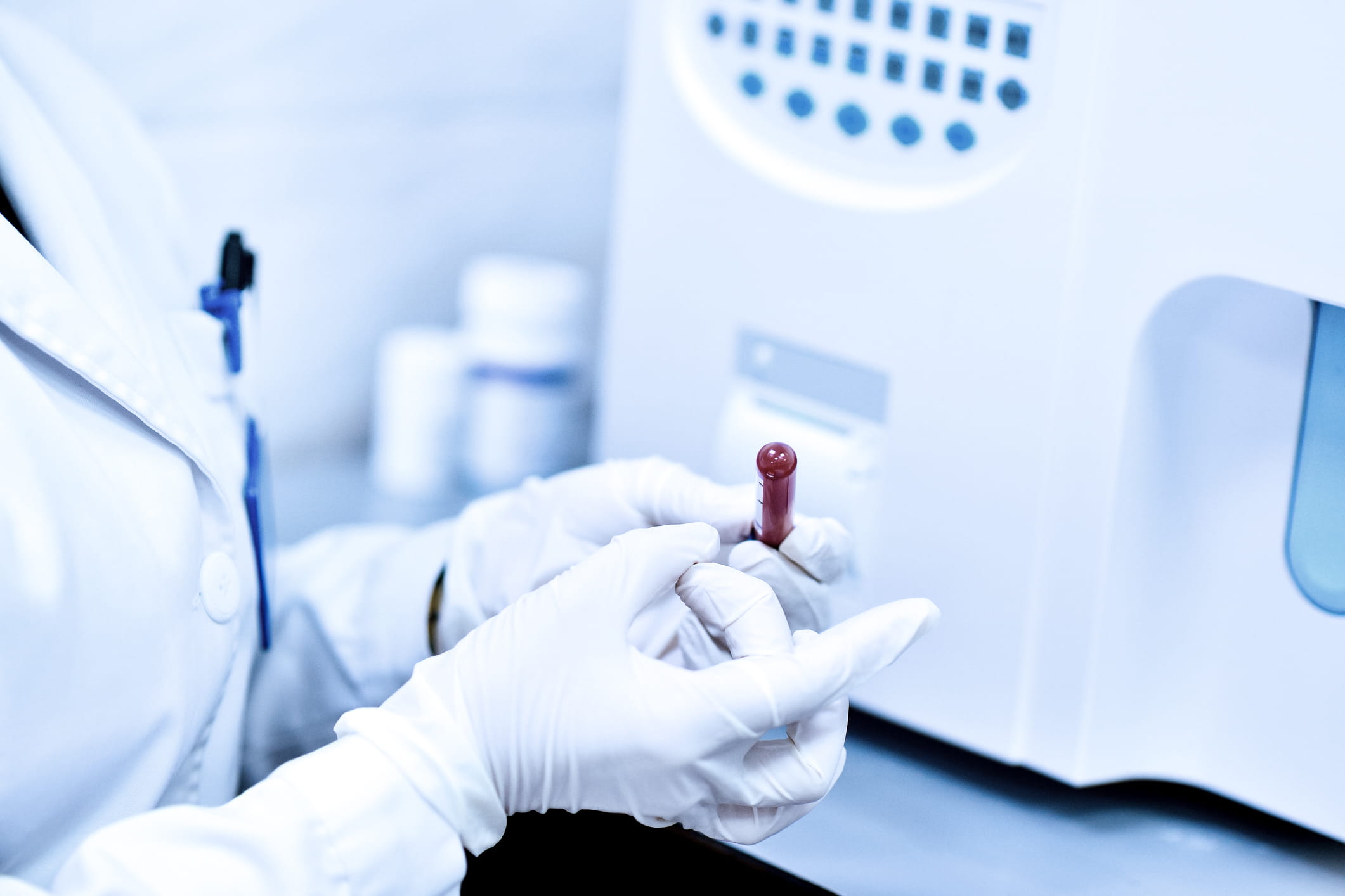Coronavirus Infektionen In Italien Bereiten Sorgen Basler Kantonalbank